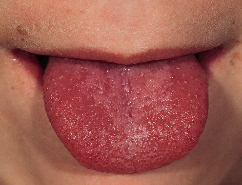 Regardez minutieusement votre langue, et si vous voyez l'un de ces ...