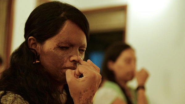 Inde: victime d’une attaque à l’acide, elle est devenue mannequin