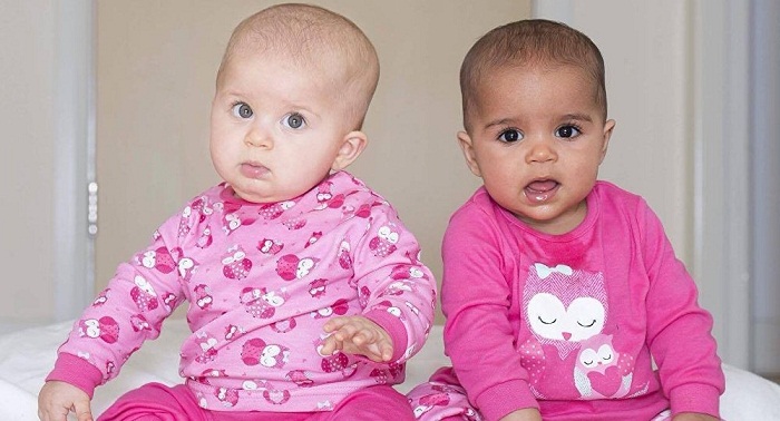 Manchester Mum Gives Birth to Black & White Twins