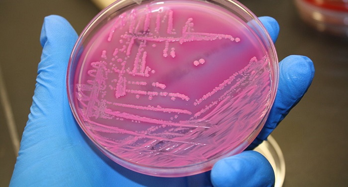 Gold Nanodiscs Offer infrared vision of life after antibiotics 