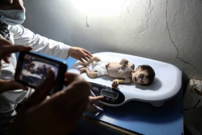 Syrie: plus de 1.100 enfants souffrent de malnutrition dans la Ghouta assiégée