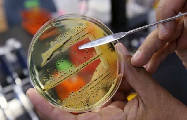 WHO names 12 bacteria that pose the greatest threat to human health