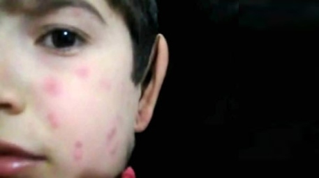 Bağçalarımızda təhlükəli virus yayılıb Bağçalarımızda təhlükəli virus yayılıb