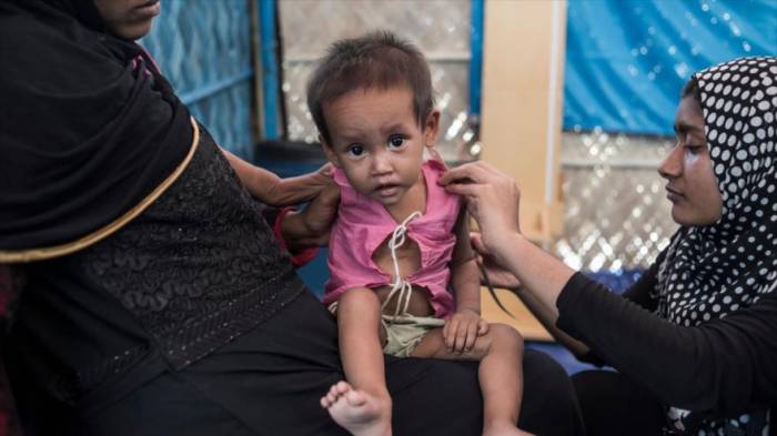 Unicef alerta: Aumenta nivel de malnutrición de niños rohingyas