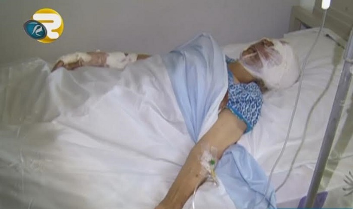 Xaçmazda çaqqallar 77 yaşlı qadına hücum etdi – Video