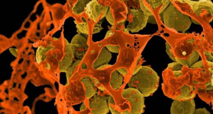 Bald schlimmer als Krebs: Superbakterien – eine Gefahr für die Menschheit