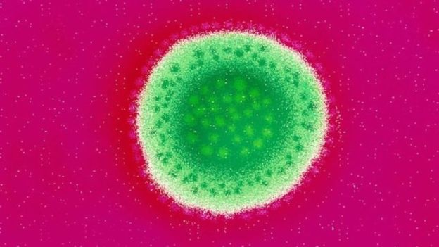 حمى لاسا: المرض القاتل الذي لا لقاح له