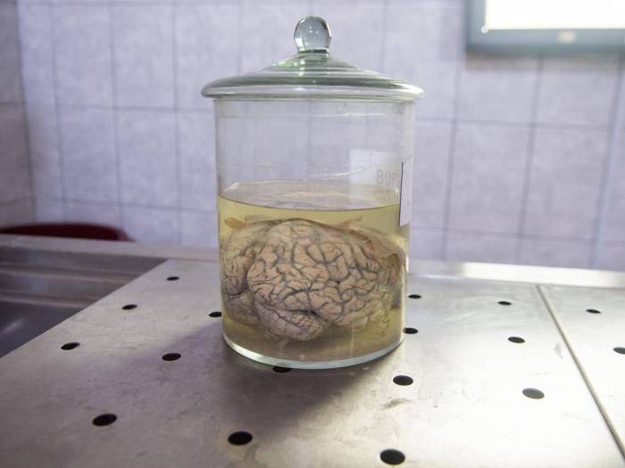 Pig brains kept alive outside bodies for first time