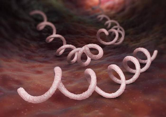 Syphilis increasing at fastest rate since 1949 