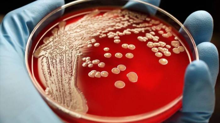 Hallan infección resistente al antibiótico más potente del mundo