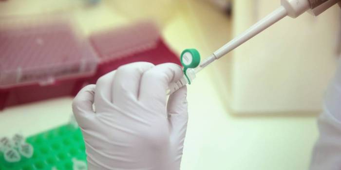 Progrès encourageant vers un vaccin contre le VIH