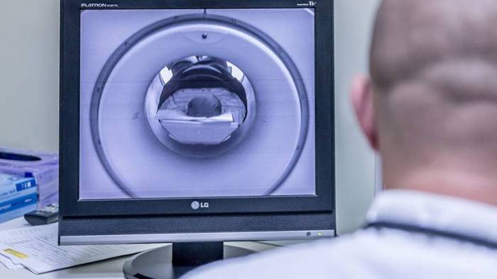 Hallan 100 huevos de tenia en el cerebro de una niña de 8 años que sufría dolores de cabeza