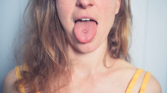 Tongue splitting: Surgeons warn of serious health risks
