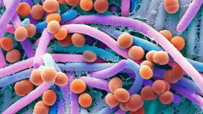 البكتيريا التي يستعين بها الأطباء لإنقاذ حياة الأطفال