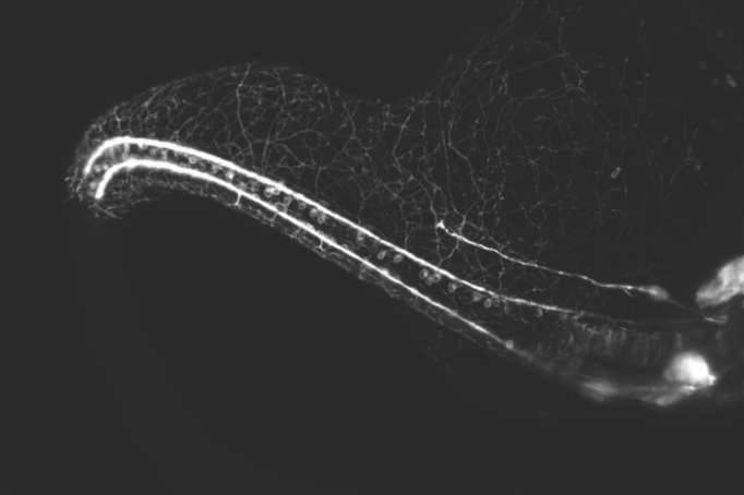 Art or science? This mesmerizing video shows the development of neurons - VIDEOS
