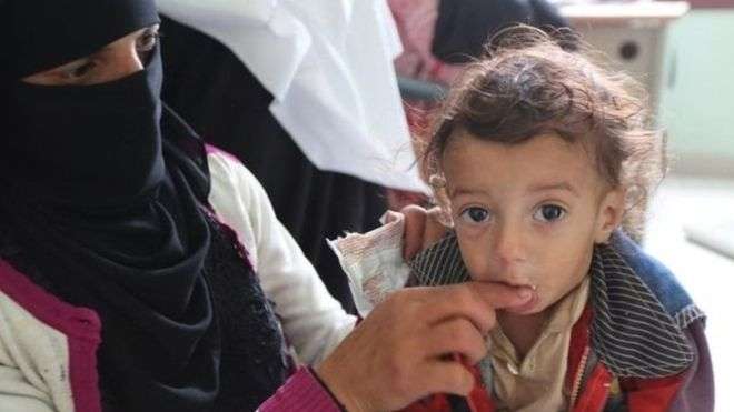 الأمم المتحدة "نخسر معركتنا ضد المجاعة" في اليمن