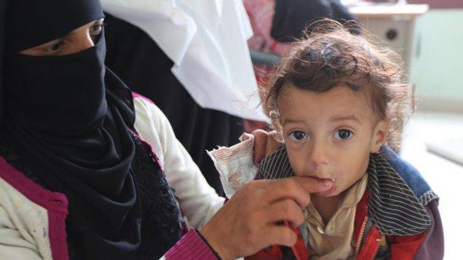 منظمة "أنقذوا الأطفال": جيل كامل من أطفال اليمن يواجه خطر القتل