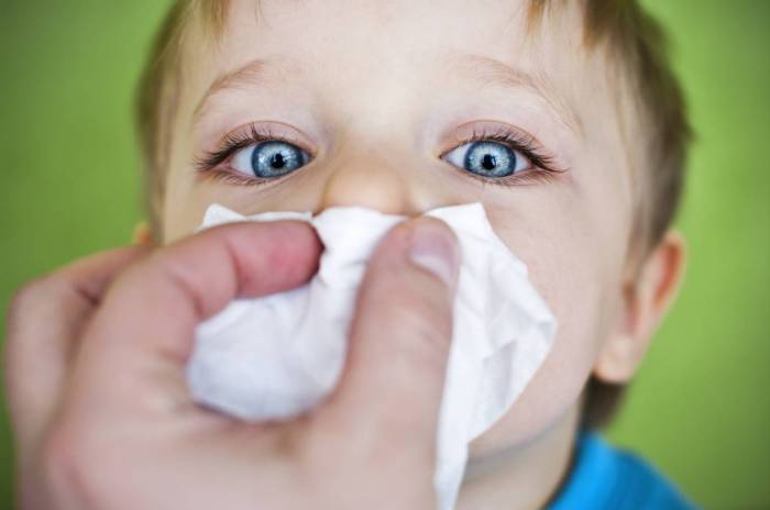 Faut-il vraiment pencher la tête en arrière quand on saigne du nez? 