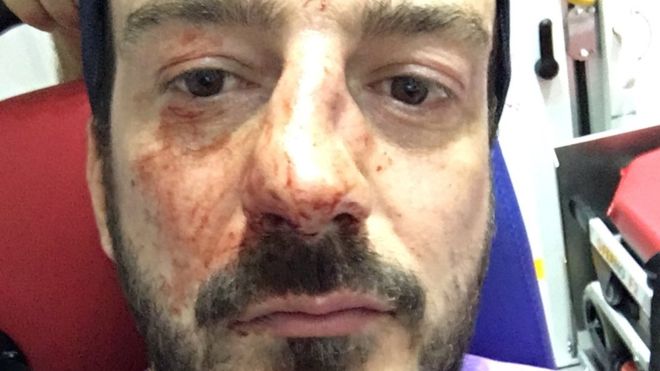 Head of anti-homophobia group assaulted in Paris