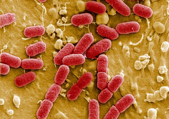 Antibiotic resistance may ‘send medical care back to the dark ages’