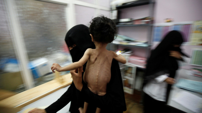 Public outcry forces Facebook to stop banning pics of starving Yemeni girl