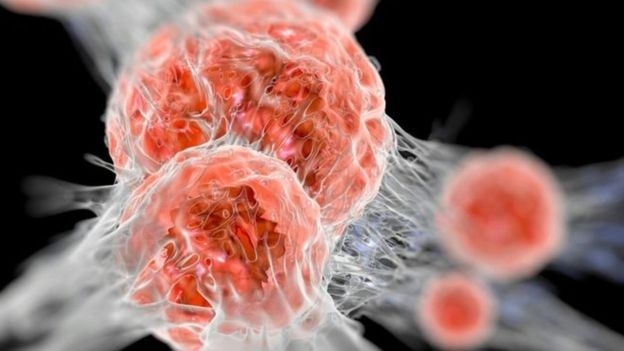 جائزة نوبل للطب لأمريكي وياباني توصلا لعلاج جديد للسرطان