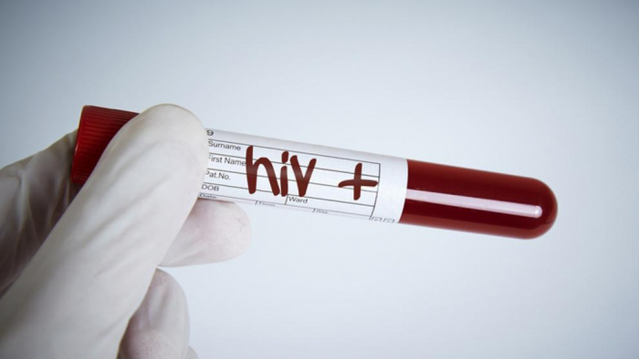Logran eliminar el VIH en seis pacientes con trasplantes de células madre