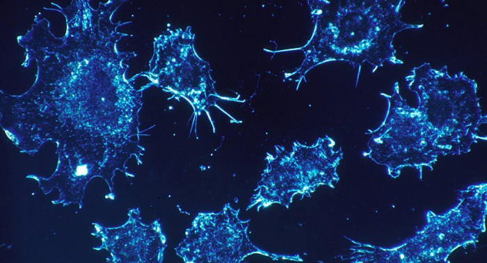 Microchips con puntos cuánticos incrementan la eficacia de la terapia contra el cáncer