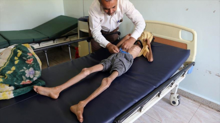 Merkel alerta: Yemen vive la peor catástrofe humanitaria del mundo