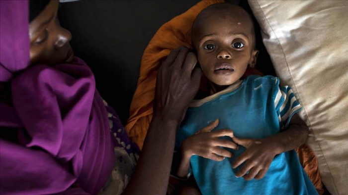 Cholera kills 71 in northeast Nigeria