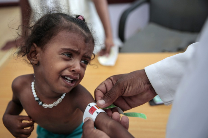 Le Yémen en guerre, un "enfer sur terre" pour les enfants (Unicef)