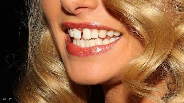 دراسة: أسنانك تكشف حالة "صحتك العقلية"