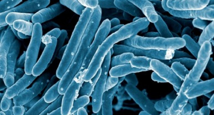   OMS:   la tasa de mortalidad por la tuberculosis se reduce en 42% desde 2000