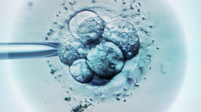 Human embryo smuggling: Malaysian arrested at India airport