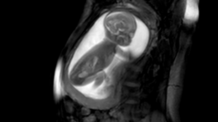 Detailed images of baby heart inside the womb