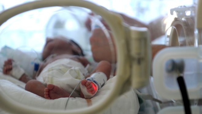 Portugal baby born to woman brain dead for three months