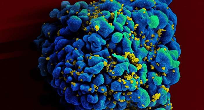 Logran por segunda vez una remisión sostenida en paciente con VIH