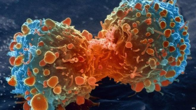 تصوير عمليات الآيض الخلوية قد يسهم في علاج السرطان