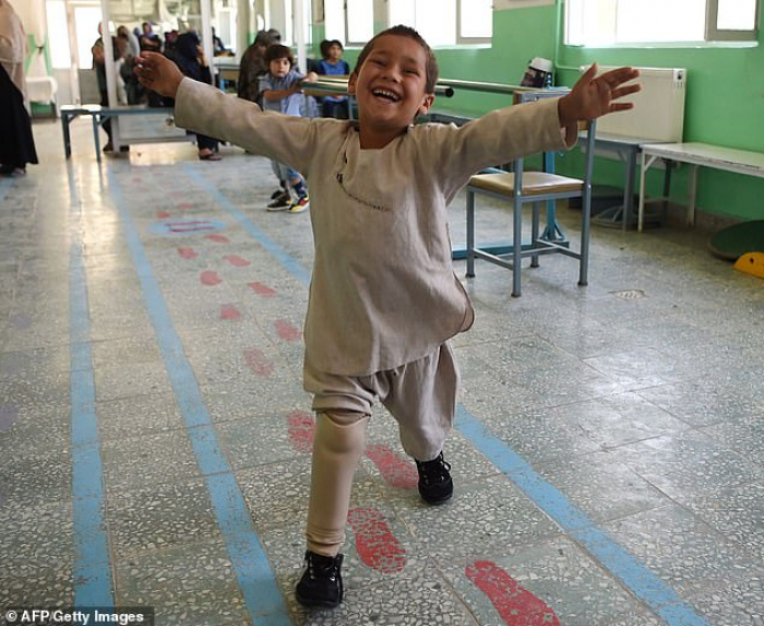   Afghanistan:  amputé, Ahmad, 5 ans, émeut le pays avec sa danse et son sourire -  VIDEO  