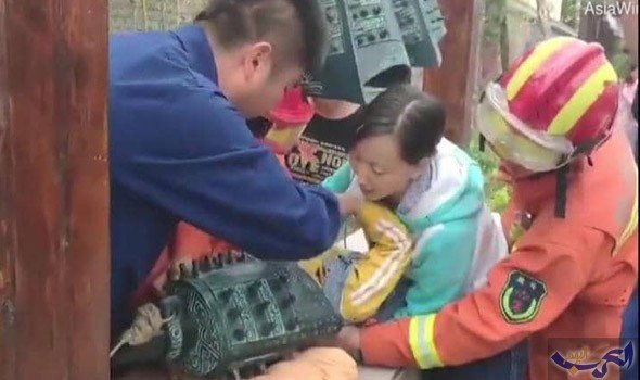 إنقاذ طفل صيني من "جرس برونزي" كاد يودي بحياته
