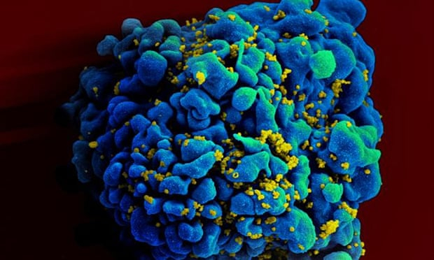 End to Aids in sight as huge study finds drugs stop HIV transmission