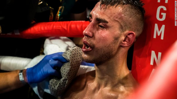 Russian boxer Maxim Dadashev dies after sustaining injuries during fight