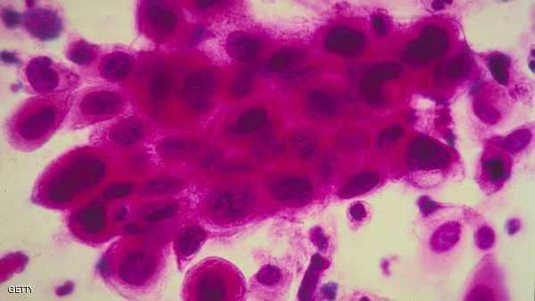 العلماء يكتشفون الخديعة الكبرى للخلايا السرطانية