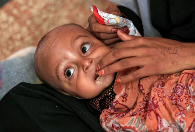 UN to resume food aid in Yemen rebel-held areas  