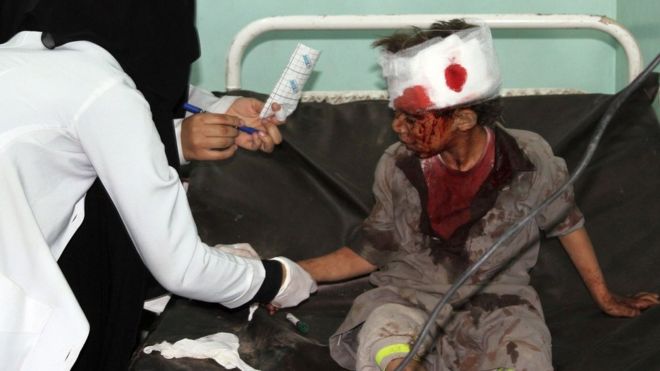 Yemen: Western powers may be held responsible for war crimes - UN