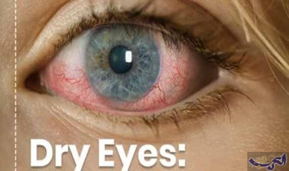 تعرَّف على أسباب جفاف العين وأبرز الحالات الشائعة