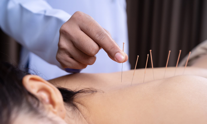 Acupuncture might treat alcohol addiction, rat study finds