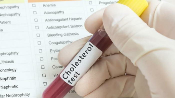 El 95 % de latinoamericanos no sabe que padece colesterol alto