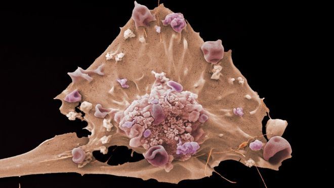 علماء يدرسون نشأة "السرطان" بهدف العلاج المبكر