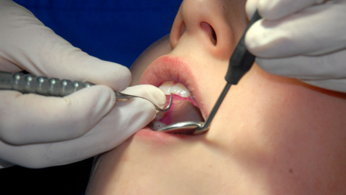 Una mujer muere desangrada luego de que dentista le extrajera diez dientes